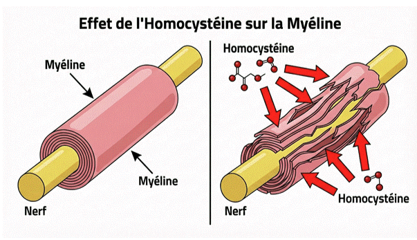 homocysteine et myeline